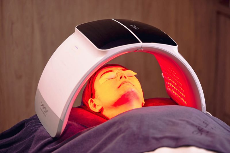 Red Omega Light therapy supporting skin recovery