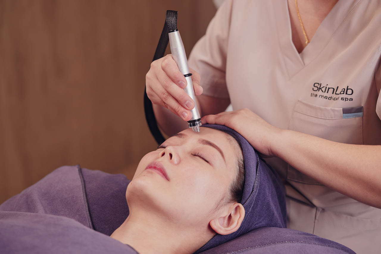 Aqua Peel treatment for oily and congested skin