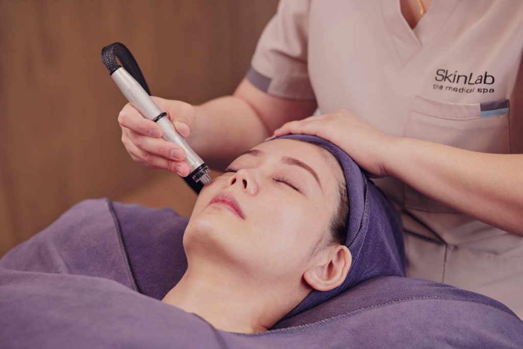 Aqua Peel Facial