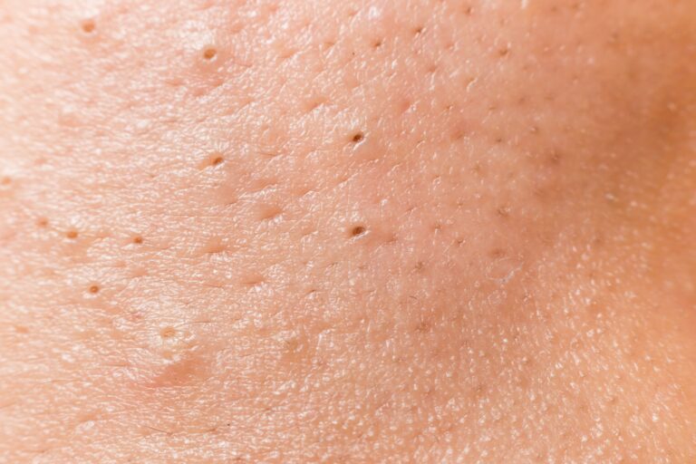 Read more about the article Are you making this mistake when cleansing your pores?