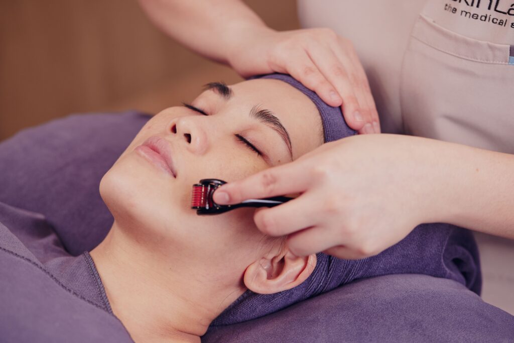 Nano Needling