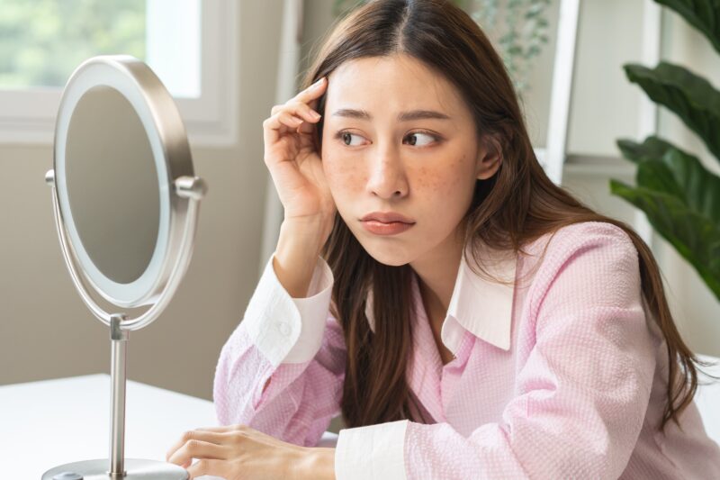 Repairing sun damaged skin naturally