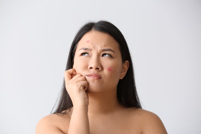 Read more about the article Are facials safe for acne-prone skin?