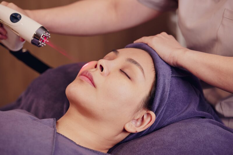 Laser Lift - Facial Acne Treatment
