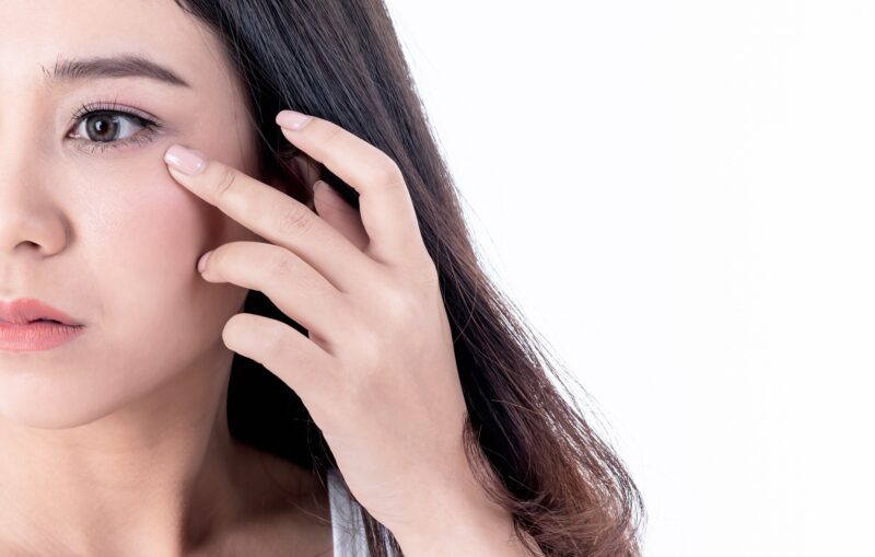 Undereye ageing