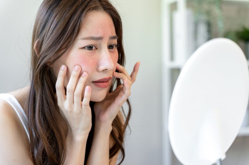 Pigmentation removal treatment