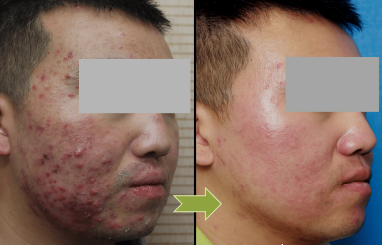 Read more about the article 6 most common skin problems in Singapore and the solution for them