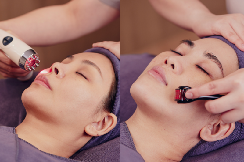 Anti ageing treatment Singapore