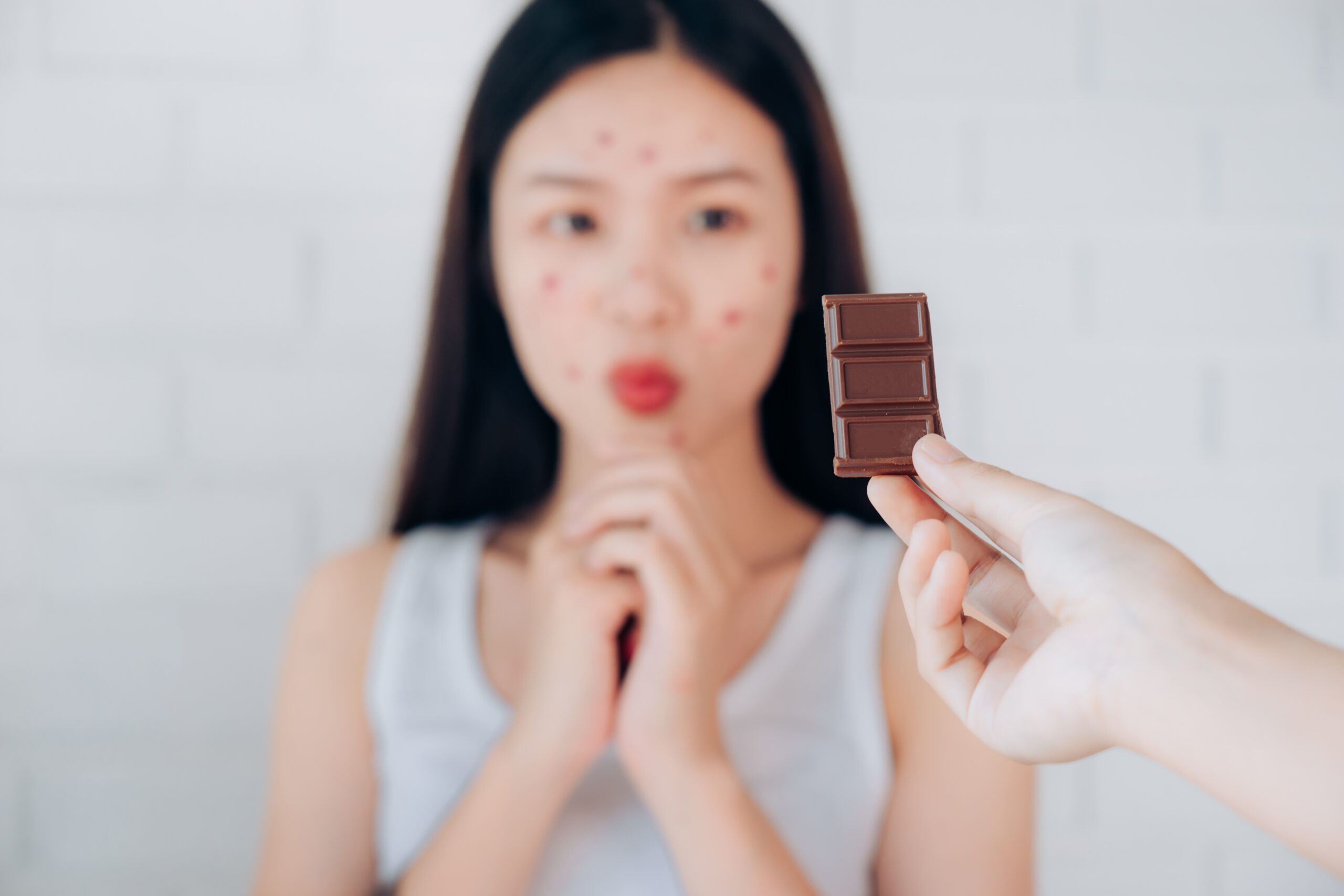 You are currently viewing Can Diet Affect Acne? How Food May Contribute to Breakouts