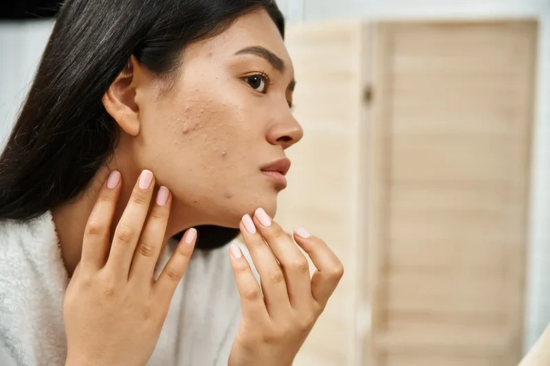 Exfoliating Gone Wrong: Why Oily Skin Gets Oilier After a Scrub