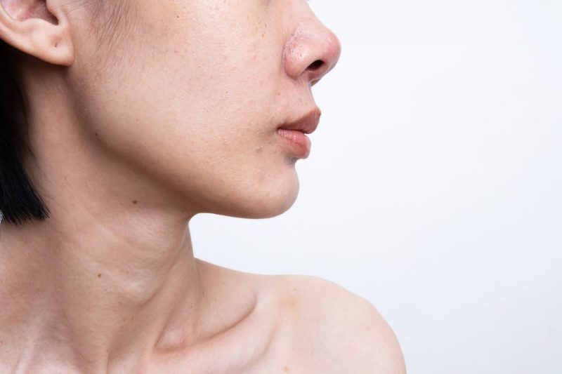 Dull vs Dehydrated vs Uneven Skin: What’s the Difference?