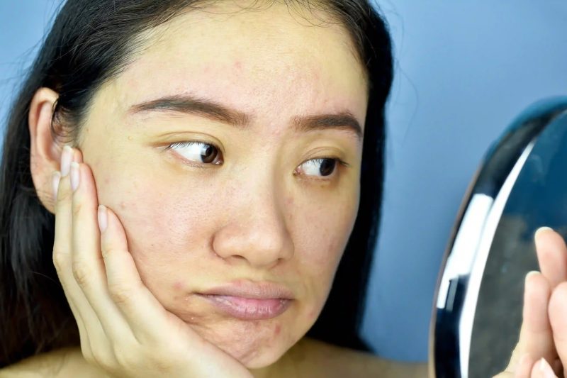 Why Your Skin Looks Dull (Even When You Sleep Well)
